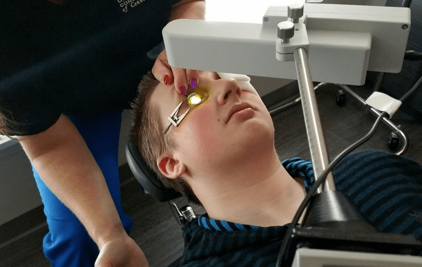 Crosslinking – Hornhautchirurgie bei Pathologien